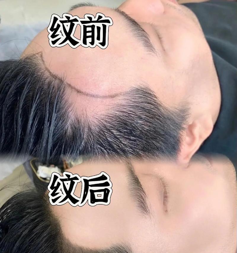 抖音发际线怎么剪辑的？视频编辑技巧有哪些？